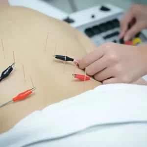 Acupuncture Packages